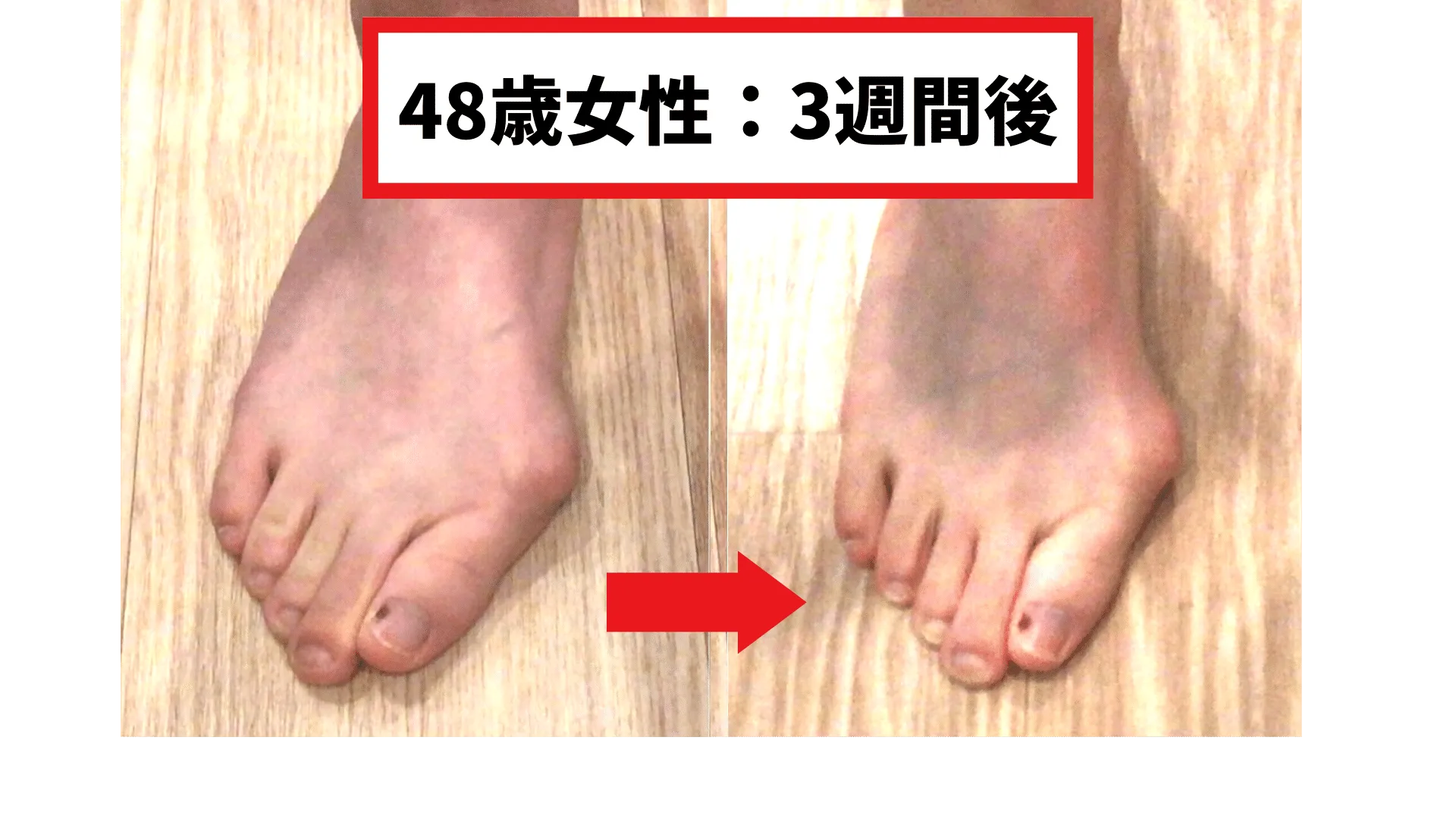 Before/After 1